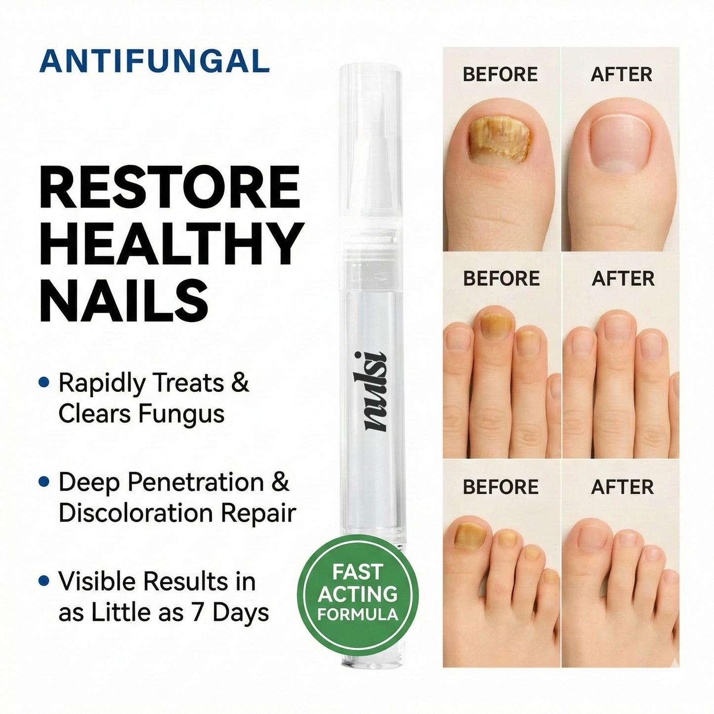 Nulsi Organic Antifungal Treatment